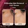 Whitening Serum